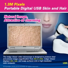 1.3M Pixels Portable Digital USB-PC Skin Scope,skin Analyzer
