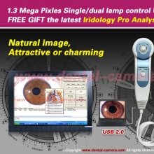 1.3MP Pro Single/Dual lamp USB Iriscope Irido diagnostic System