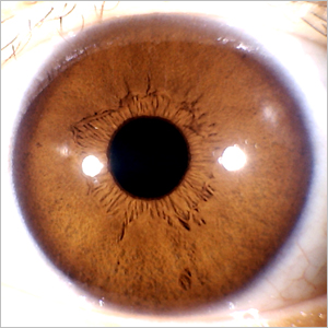 Iriscope | Iridology Camera | Eye Camera