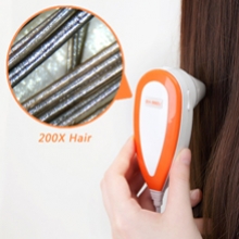 500万像素电脑型毛发检测仪,头发测试仪,头发检测仪